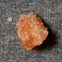 Result Photo
